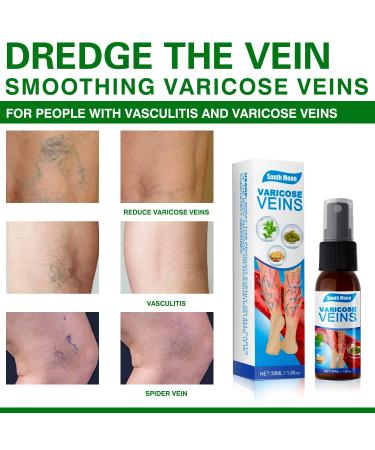 2 Pieces Veinhealing Varicose Vein Treatment Spray | Soothing Relief for Legs | Effective Varicose Vein Spray - Buy Online on GoSupps.com