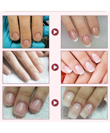 Terrain-Hill Nail Repair Protection Gel - Instant Cracked Nail Repair Kit for Natural Nails (1 Set) - Buy Online on GoSupps.com