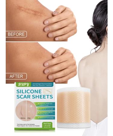 Buy Silicone Scar Sheets - 2 Boxes (1.6 x 60 Roll) for Effective Scar Removal | Reusable Silicone Scar Tape for All Types of Scars - International Shipping Available - Buy Online on GoSupps.com