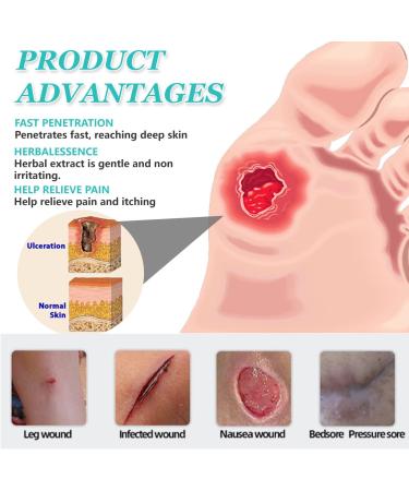  MagiSel Anti Bedsore Cream Sore Sores Healing Cream Soothing Sore Cream Bed Wound Treatment Cream Fast Wound Healing Gel 20g x 2 Boxes - Buy Online on GoSupps.com