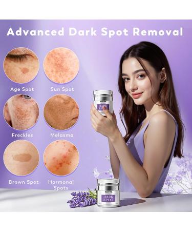 HANYWIL Dark Spot Remover for Face & Body Remedy for Dark Spots with Natural Ingredients Dark Spot Corrector Cream and Serum for Skin Care Treats Freckles Melasma Sun Spots Women & Men 1.7 Fl Oz 1.7 Fl Oz (Pack of 1) - Buy Online on GoSupps.com