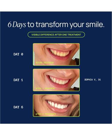 Laughland Original Teeth Whitening Kit, Phone-Powered LED Mouthpiece & 3 Whitening Gel Syringes, 8% Hydrogen Peroxide, Aloe Vera & Mint, for Sensitive Teeth, at-Home Dental Care, 6+ Treatments Original 1 Count (Pack of 1) - Buy Online on GoSupps.com