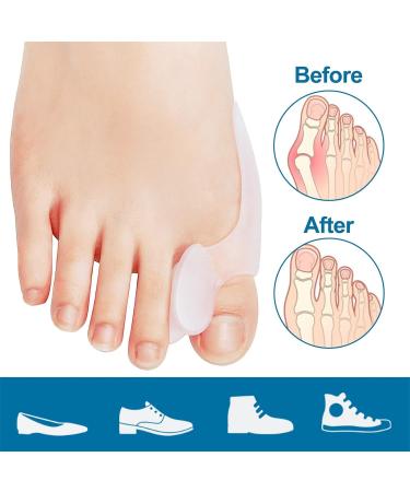 8 Bunion Cushion Protectors - Pain Relief & Corrector Pads for Hallux Valgus - Big Toe Bunion Shield & Toe Spreader - Buy Online on GoSupps.com