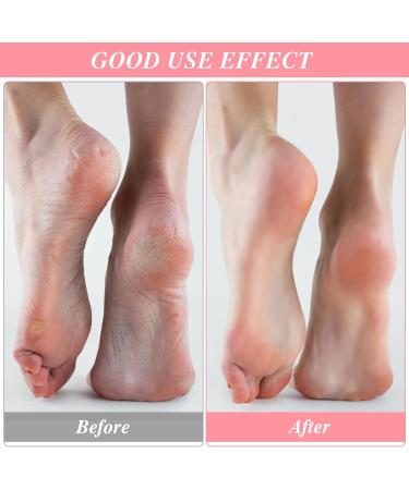 Buy 3 Pairs Aloe Moisturizing Spa Socks - Fuzzy Non-Slip Foot Care for Dry Feet & Cracked Heels | Perfect for Overnight Repair - Buy Online on GoSupps.com