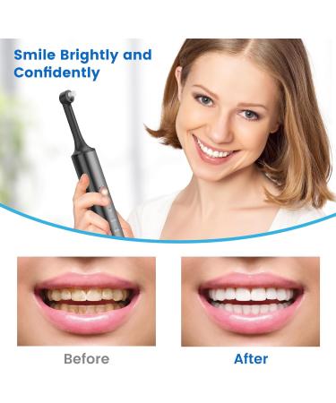 Tooth Polisher NAUQUOHZ Teeth Cleaning Kit for Daily Cleaning & Teeth Whitening for People/Pets 5 Brush Heads 4 Speed Modes Waterproof and LED Light Black - Buy Online on GoSupps.com