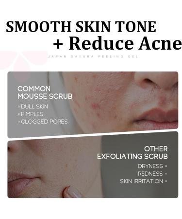 Sakura Face Scrub Hydrating Face Exfoliator Scrub Body Scrub for Dead Skin Reduce Acne & Even Skin Tone Smoothing Scrubs & Body Treatments Skin Exfoliator-Face & Back & Knee Blackhead Cleanser-60g - Buy Online on GoSupps.com