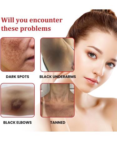  BEROZA Set of 3 Creams for Face Spots Whitening Cream for Freckles Dark Spot Removal Cream Cream for Dark Spots Skin Lightening Cream for Face Spots - Buy Online on GoSupps.com