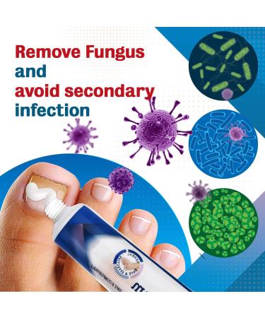 Kopa Haiku Anti-Fungal Skin Cream - Athlete's Foot & Jock Itch Treatment for Men - Antifungal & Anti-Itch Cream for Ringworm, Eczema on Face & Body - Buy Online on GoSupps.com