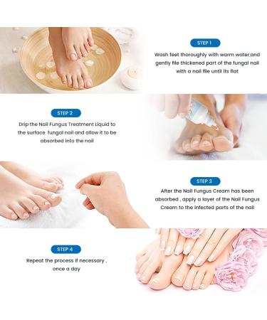 Fungal Nail Treatment - Fungal Nail Treatment for Toenails Extra Strong - Anti Fungus Nail Repair and Strengthen - Toenail Fungus Treatment for Thickening Yellow-Brown Discoloration Ragginess 20ML - Buy Online on GoSupps.com