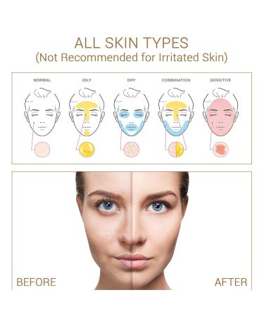 Hydrating Niacinamide with Salicylic Acid Serum for Face | Dark Spot Corrector & Plump Skin | 1 fl. oz Made in Europe - Buy Online on GoSupps.com