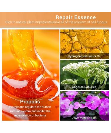 Fungal Nail Treatment For Toenails Nail Repair Essence Extra Strong Extra Strong Nail Fungus Treatment for Toenail Fingernail & Toenail Care Solution 2024 New (1 Bottle) - Buy Online on GoSupps.com