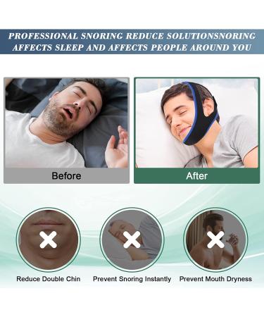 Adjustable Anti Snoring Chin Strap for Men and Women - Breathable, Comfortable and Effective - Blue - Buy Online on GoSupps.com