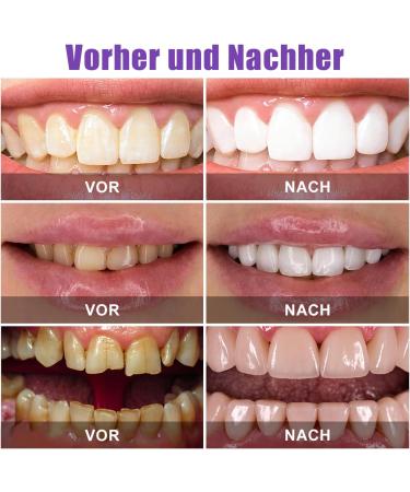 Buy 2 Piece Purple Teeth Whitening Toothpaste - V34 Color Corrector Serum for Coffee & Smoke Stain Removal | Brighten Yellow Teeth Naturally - Buy Online on GoSupps.com