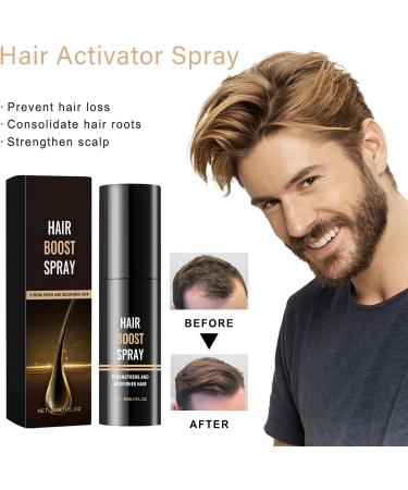 Hair Growth Spray Ginger Hair Growth Serum with Ginseng Hair Regrowth Essence for Men & Women Repairs Hair Follicles Moisturize Scalp and Promote Hair Growth Strengthen Hair Root - Buy Online on GoSupps.com