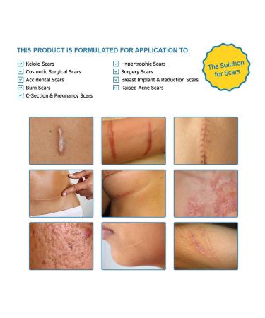 Aroamas Silicone Scar Removal Sheets 4 pcs White Professional, Drug-Free Solution for Burn, Keloid, Acne, Surgery Scars Soft Adhesive Fabric Strips, 2 Month Supply - Buy Online on GoSupps.com