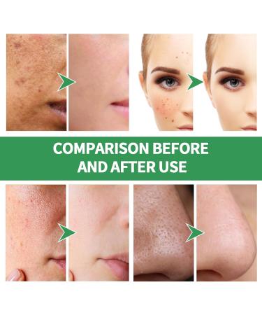 Green Tea Face Mask Natrual Skin Mask Body Mud Mask Blackhead Removal Mask Smoothing Daily Skincare Green Tea Cleansing Mask Deep Cleanse & Reduce Acne Hydrating Face Moisturizes-Dull Skin-100ml - Buy Online on GoSupps.com