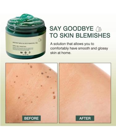  SONGVISON Instant Mole & Spot Removal Gel Dark Pigment Lightening Gel Skin Correcting Moisturizing Serum for Women - Buy Online on GoSupps.com