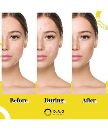 ORG Peel Off Face Cleanser - Gentle Exfoliation for Glowing Skin - Korean Sensitive Skincare - Pore Minimizer & Brightening Agent - Cruelty Free Natural Formula - 2oz - Buy Online on GoSupps.com