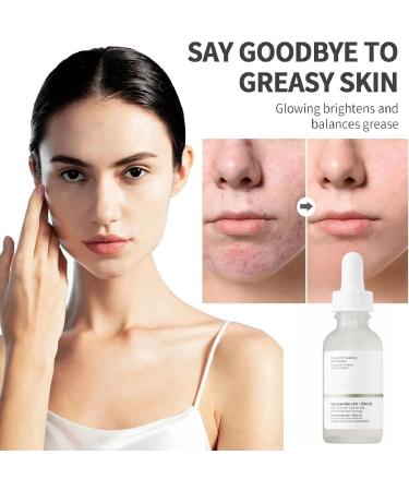 60ML 10% Niacinamide Serum + 1% Zinc Serum Niacinamide Moisturiser Control Excess Oil and Redness Serum Brightening Serum Dark Spot Remover Skin Tightening Cream Anti Aging & Wrinkle Face Serum - Buy Online on GoSupps.com