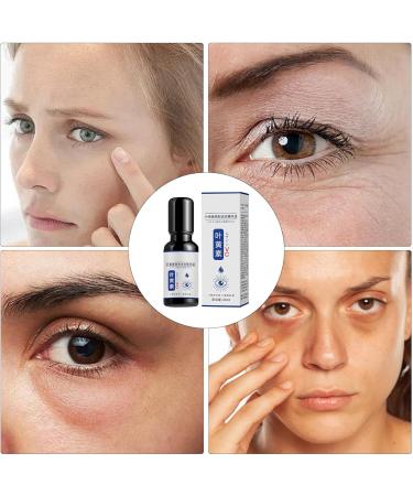  Generisch Lutein Oil for Eyes Lutein for Eyes Skin-Friendly Solution Natural Lutein Ball Oil for Nourishing and Moisturizing Skin Around Eyes - Buy Online on GoSupps.com