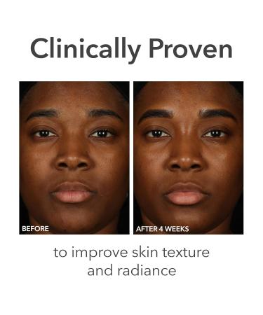 Dr Dennis Gross Alpha Beta pH Balance Replenishing Cream Lightweight Gel-Cream with Electrolytes Phytic Acid & AHAs - Hydrates Soothes & Balances Skin 1.7 fl oz - Buy Online on GoSupps.com