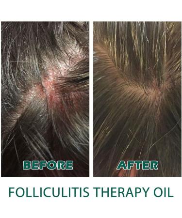 FIOERDTUIE Adults Hair Growth Essential Oil Follicle Repair Moisturizing Nourishing Essence Haircare Serum Beauty Supplies - Buy Online on GoSupps.com
