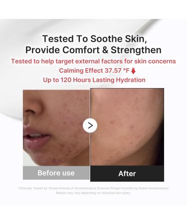 medicube Comforting Serum & Cream Duo Ideal for After Spot Care: TXA Serum and 3H Daily Moisturizer | Calming Tone Refining & Glow Routine - Buy Online on GoSupps.com