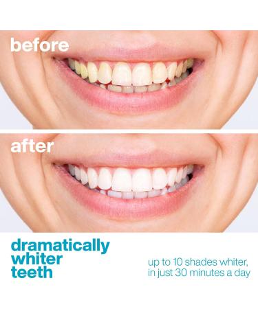 Aquasonic Teeth Whitening Strips - Dentist-Quality, Fast & Effective Results - Buy Online on GoSupps.com