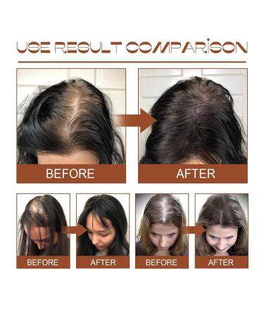 Buy 100% Natural Batana Oil for Hair Growth - Dr. Sebi Inspired Prevent Hair Loss & Enhance Thickness - Raw from Honduras - Buy Online on GoSupps.com