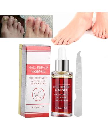 Nail Repair Essence 15ML Nail Fungus Treatment Natural Nail Care Toe Nail Fungus Treatment for Damaged Discolored Nails Antifungus Nail Treatment - Buy Online on GoSupps.com