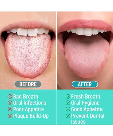 Buy Stainless Steel Tongue Scraper for Adults & Kids | 2 Pack Double Scraping Heads with Travel Case for Fresh Breath - Silver - Buy Online on GoSupps.com