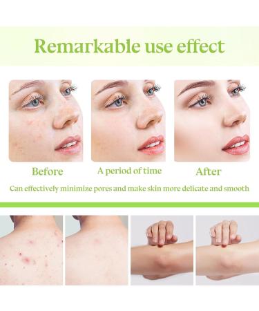 3PCS Gentle Exfoliating Gel Moisturizing Facial Exfoliator Deep Cleansing Peeling Gel for Face and Body Non-greasy Exfoliating Face Scrub Lightweight Facial Scrub Exfoliator for All Skin Types - Buy Online on GoSupps.com