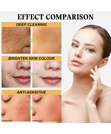 24K Gold Peel Off Mask | 98.4% Pure Gold Facial Mask | Deep Cleansing & Moisturizing | Blackhead Remover & Fine Lines Reduction - Buy Online on GoSupps.com