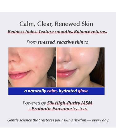 liv.reome MSM Sulfur-Derived Redness Recovery Cream for Sensitive Thin Skin Probiotic Exosome + Panthenol + Ceramide NP - Buy Online on GoSupps.com