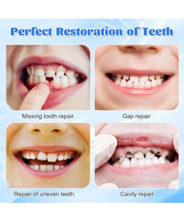 PGonline Temporary Tooth 30g Tooth Repair Kit Dental Plasters Fixed Dental Beads Temporary Teeth False Tooth for Missing Broken Teeth Dental Filling Material - Buy Online on GoSupps.com