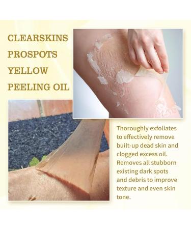 Body Peeling Oil Brightening Oil for Dark Skin Extra Strong Peeling Oil Peeling Oil for the Body Extra Strong Yellow Peeling Yellow Peeling Oil for Dark Skin (1PC) - Buy Online on GoSupps.com