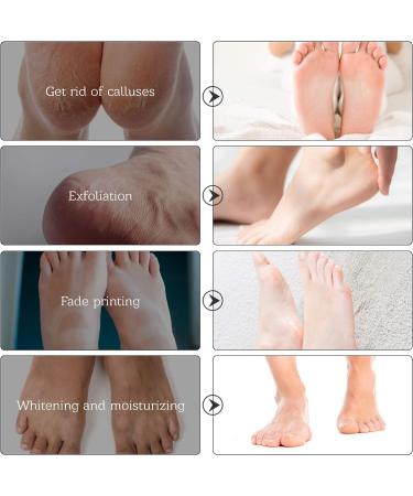 5 Pairs Rose Foot Mask - Exfoliating Callus Remover for Soft Smooth Feet | Peeling Foot Masks for Men & Women (40g) - Buy Online on GoSupps.com