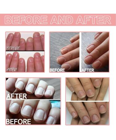 Nourishing Nail Nutrient Oil Kit for Strengthening and Healthy Cuticle Remover Cream with Tools (YS25-2) - Buy Online on GoSupps.com