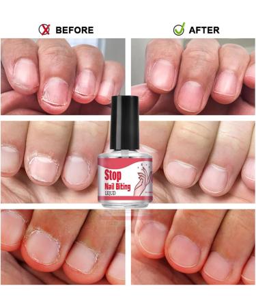 Mihauuke Bitter Nail Polish - 10ML Anti Bite Nail Polish | Stop Biting Nails Stop Nail Biting Solution Safe Long-Lasting For Kids And Adults To Curb Nail Biting - Buy Online on GoSupps.com