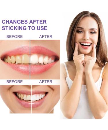 KLYso Gentle Cleaning Toothpaste - Remove Tartar Stains & Bad Breath Whiten Teeth Fresh Breath & Mineral - Rich Oral Care(2PCS) - Buy Online on GoSupps.com