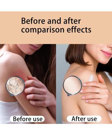 Rose Moisturizing Body Lotion - Ultra Moisturizing Cream for Men Women & Children - 8 oz | Suitable for All Skin Types - Buy Online on GoSupps.com