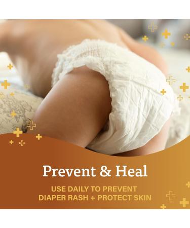 A+D Original Diaper Rash Ointment Prevents & Treats Diaper Rash Protectant Ointment - Moisturizing Skin With Vitamins A&D - 4oz - Buy Online on GoSupps.com