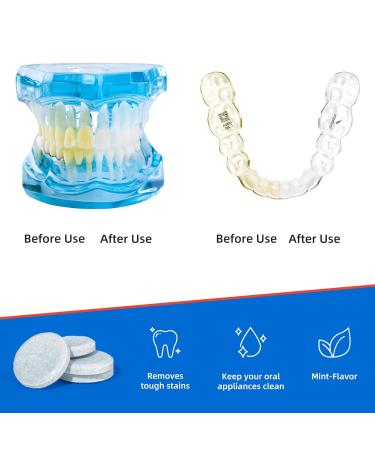 Denture Cleaning Tablets - 120 Retainer Cleaner Tablets, Removes Odors & Stains - For Dentures, Night Guards, Retainers, Aligners & Dental Appliance Cleaner - Mint Flavor - 4 Month Supply - Buy Online on GoSupps.com