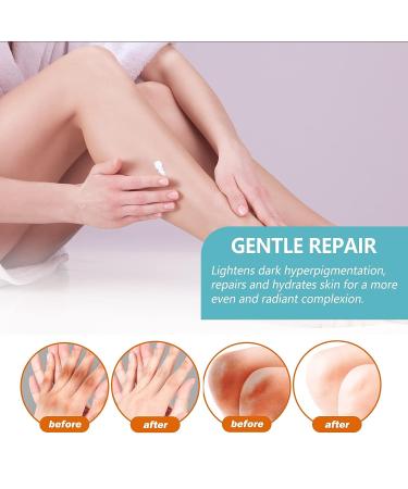 2Pcs Advanced Acanthosis Nigricans Treatment Body Cream - Dark Neck Cream for Damaged Skin - Exfoliating Therapy Oil - Buy Online on GoSupps.com