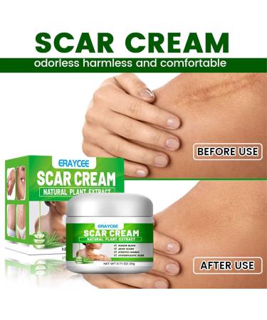 Scar Gel | Natural Calming Moisturizing Aloe Gel for Skin Lightening - Professional Scar Eraser Non-greasy Scar Repair Skin Care for Wounds Sysdisen - Buy Online on GoSupps.com