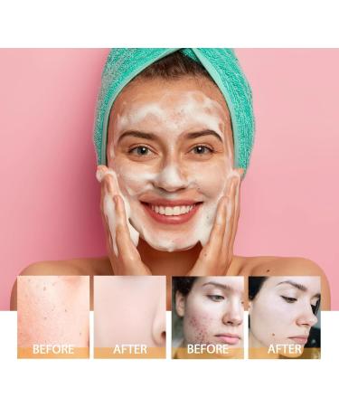 Nettoyant Visage Nettoyant En Profondeur - Att nue Les Marques D'acn R tr cit Les Pores Hydrate Et Illumine La Peau Usage Quotidien Doux(1PCS) - Buy Online on GoSupps.com