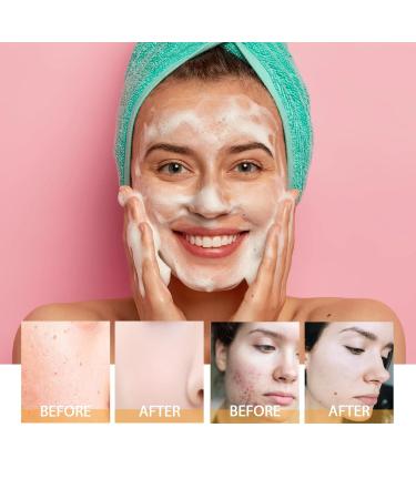 Deep Cleansing Facial Cleanser - Fades Acne Marks Shrinks Pores Moisturizes & Brightens Skin Gentle Daily Use(2PCS) - Buy Online on GoSupps.com