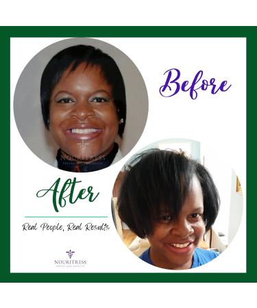 NouriTress Perfect Hair Biotin Gummies - 60 ct. | 5000 mcg | Soft Chew | Supports Healhty Hair Skin and Nails | Strawberry Flavored | Soft Chew | 1 Month Supply - Buy Online on GoSupps.com