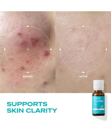 BLANC NATURE Magic Tea Tree Oil Spot Care for Face Clarifying Facial Oil for Oily and Sensitive Skin Lightweight and Fast Absorption Vegan Korean Skincare 0.68 fl oz (20ml) - Buy Online on GoSupps.com