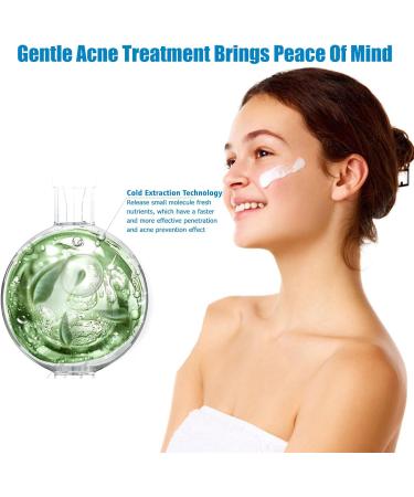  QEEROYO Anti-Acne Cream Spot-Treated Acne Treatment Facial Acne Cream Anti-Blemish Face Cream Moisturizes Skin Eliminates Blemishes and Redness for Men and Women 25g - Buy Online on GoSupps.com